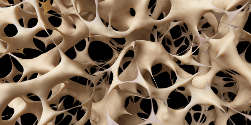 پوکی استخوان | ۱۸ عامل موثر ابتلا به پوکی استخوان در خانم ها و آقایان